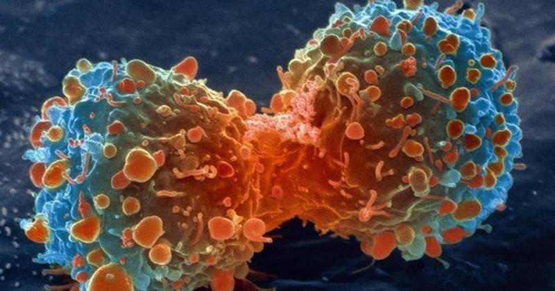 10 mythes populaires sur le cancer (et pourquoi ils sont faux)