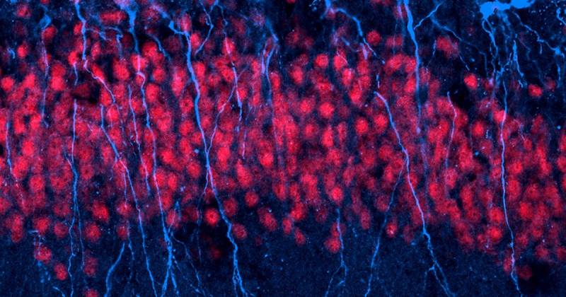 Neurogenesis bagaimana neuron baru dicipta?